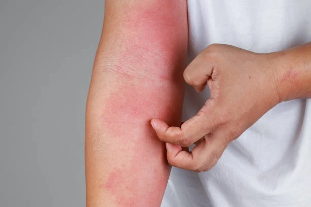 Best allergologist in USA