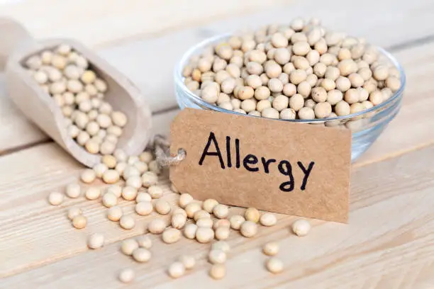 Soy allergy virtual treatment in USA