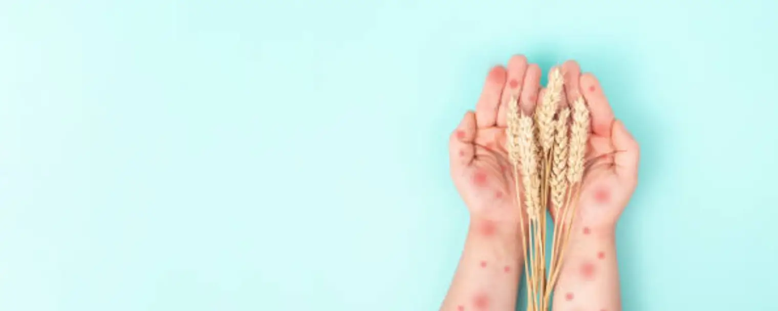 Wheat allergy virtual treatment in USA