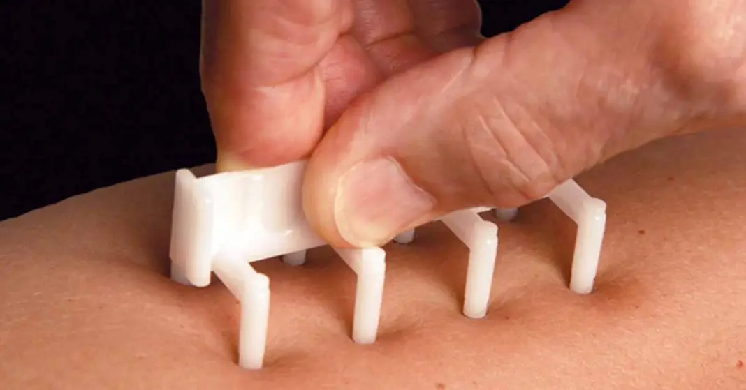 allergy test in USA