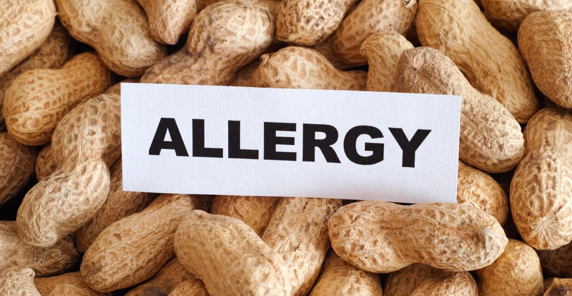 Food allergy virtual treatment in USA